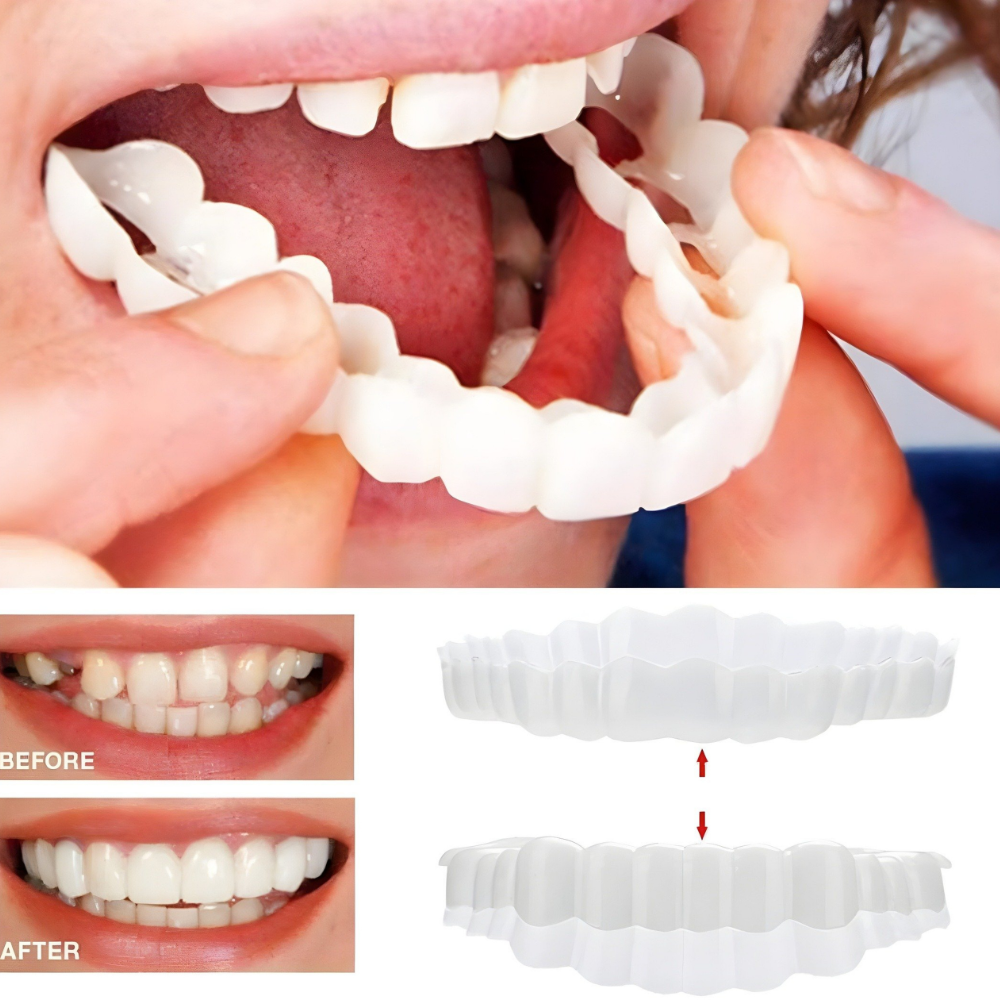 Removable Veneers Teeth Cover