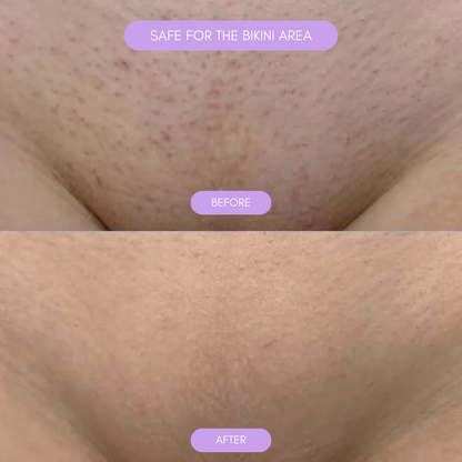 Urządzenie do depilacji dla gładkiej, miękkiej skóry