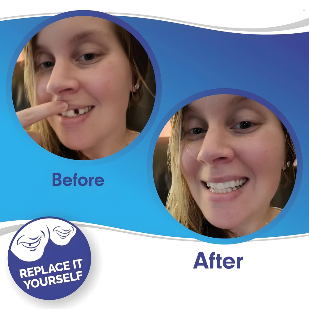 Coques dentaires amovibles