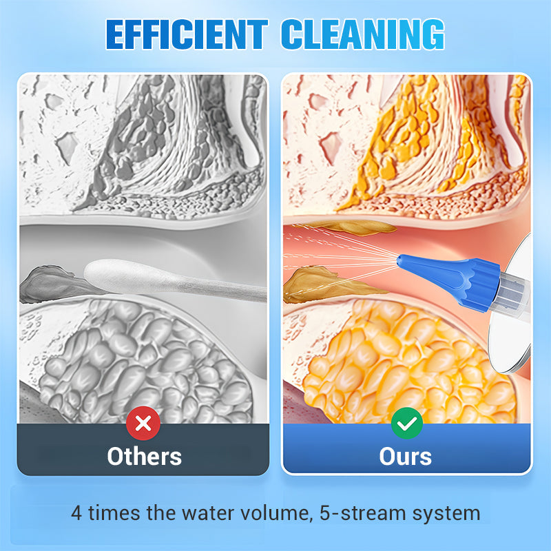 EarEase – Gentle Ear Cleaning Kit